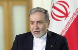 زیپ شلوار عراقچی مساله برخی رسانه‌ها شد/ عکس